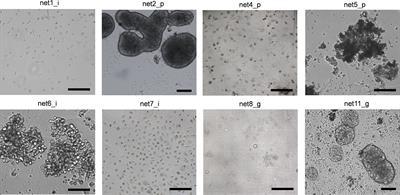 HRAS overexpression predicts response to Lenvatinib treatment in gastroenteropancreatic neuroendocrine tumors